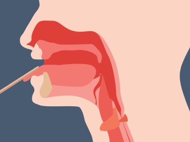 Illustration of a throat cross-section with a swab reaching inside, for medbridge.