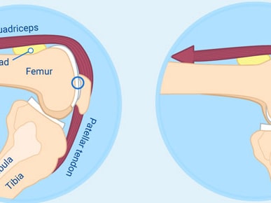 Diagram of knee anatomy highlighting the quadriceps, fat pad, femur, patellar tendon, fibula, and tibia from two angles.