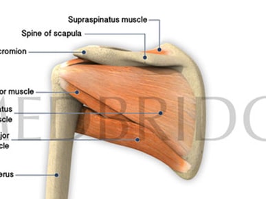 Diagram of shoulder anatomy with humerus, acromion, spine of scapula, and muscles including supraspinatus, teres minor, infraspinatus, teres major for a medbridge course.