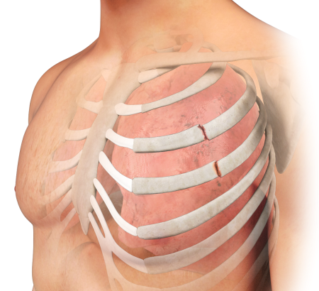 Emergency Management for Sports Therapy (Certificate)