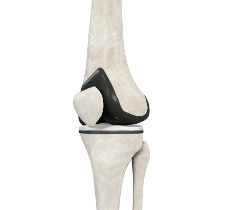 Total Joint Replacement (Certificate)