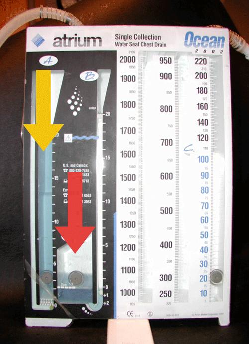 A medical chest drain device with a water seal, digital enhancements for precision monitoring, and medbridge branding.