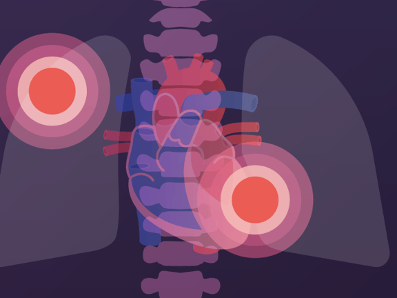 Illustrated heart and lungs with target circles on a dark Medbridge background.