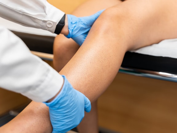 anterior drawer test