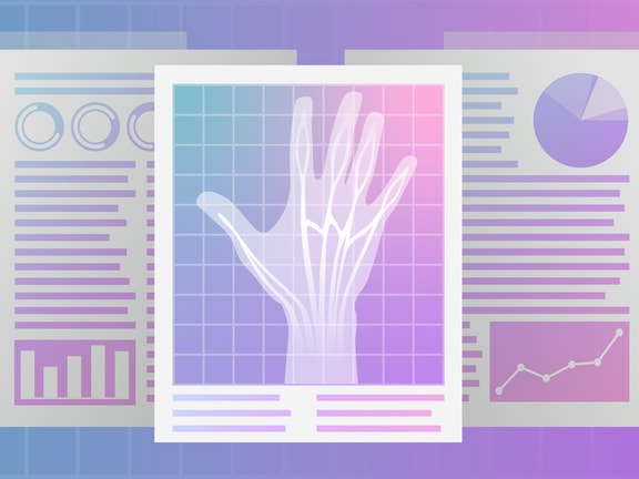 X-ray hand scan over financial documents on a blue to pink gradient background for medbridge.