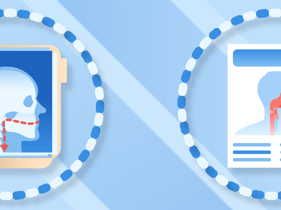 Side view illustration of a skull, spine, and throat anatomy on a blue striped background for medbridge.