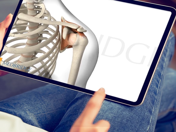 Tablet showing an anatomical illustration of a skeleton's shoulder, related to medbridge content.