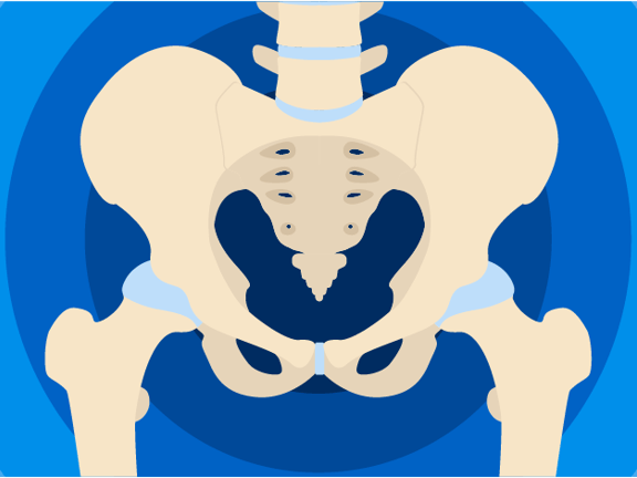 Illustration of a human pelvic bone on blue concentric circles, designed for medbridge.