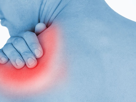 Person with bare back holding a shoulder highlighted in red for pain, per medbridge graphics.