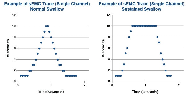 Two graphs show sEMG traces: a normal swallow with a sharp peak on the left, and a sustained swallow with a prolonged plateau on the right, important for medbridge software.