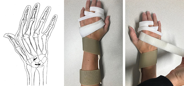 An illustration of hand anatomy and two photos of bandage wrapping showcase healthcare techniques, used on medbridge.