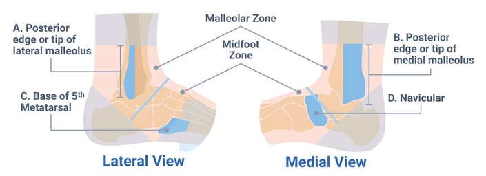 ottawa ankle rules - clinical decision rule chart