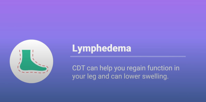 Diagram of a swollen leg labeled "Lymphedema" with text about treatment benefits on a purple background and the medbridge logo.