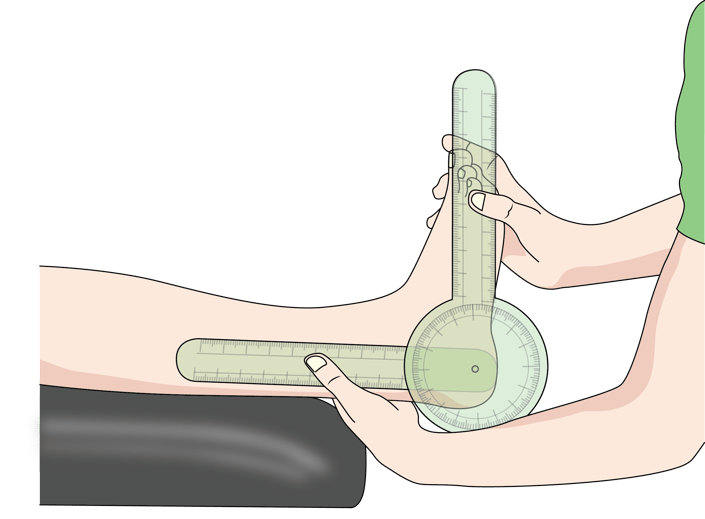 A green protractor measures a knee's angle on a black surface, illustrating Medbridge's digital healthcare precision.