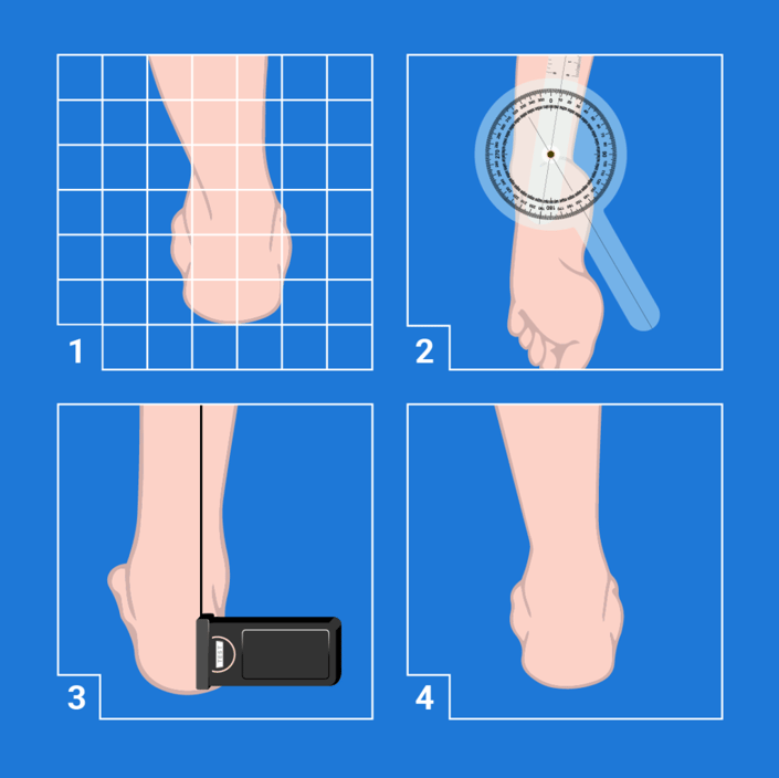 Four diagrams show foot measurement techniques, aiding digital healthcare through Medbridge software integration.