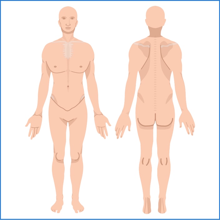 A digital illustration of human anatomy showing muscles and the skeletal structure, used for healthcare training on Medbridge.